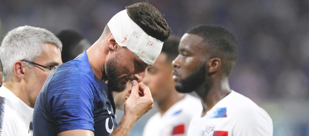 Giroud injury scare as France held to draw